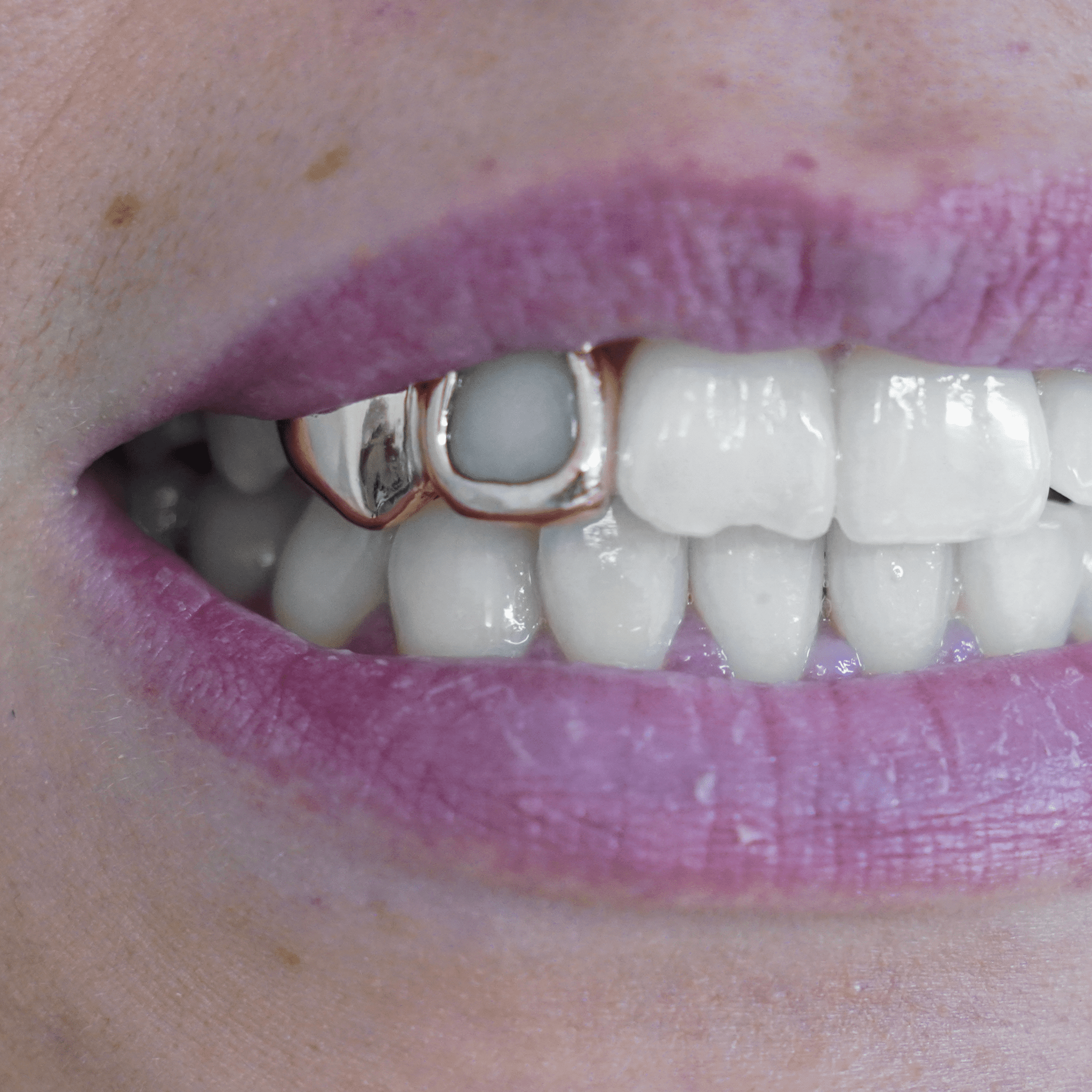 Pleine + Fenêtre - Grillz 2 Dents Yell Lab