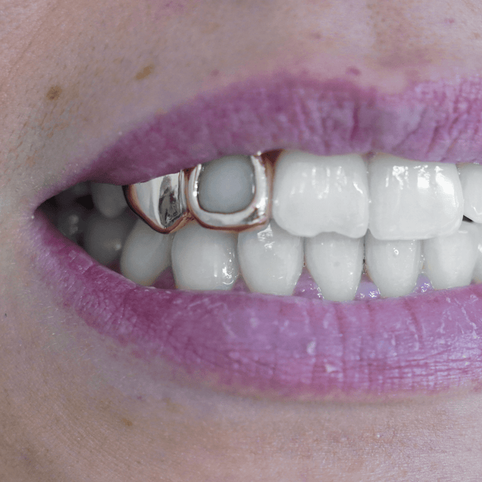Pleine + Fenêtre - Grillz 2 Dents Yell Lab